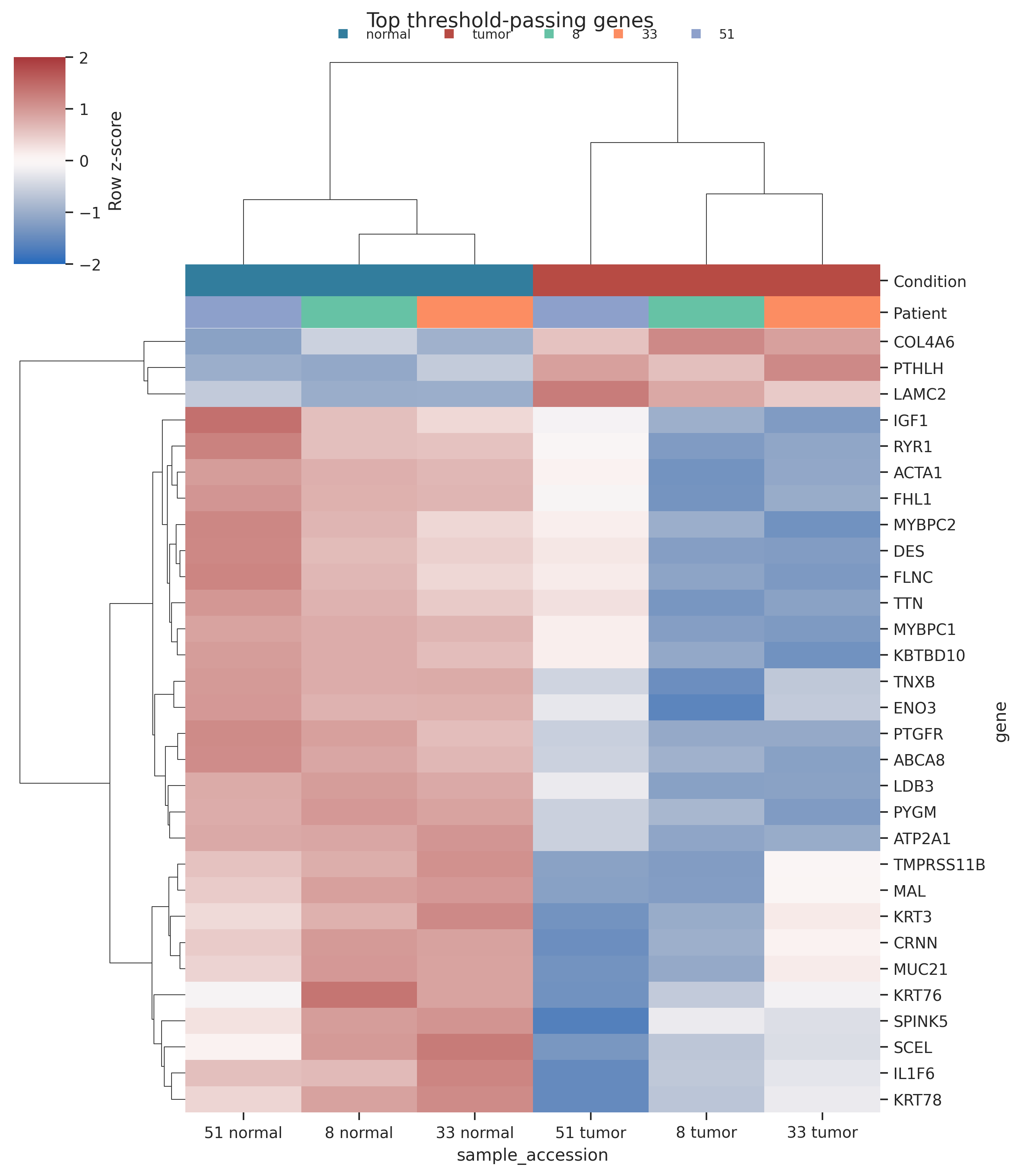 Clustered heatmap of the top differentially expressed genes across tumor and normal samples, annotated by condition and patient.